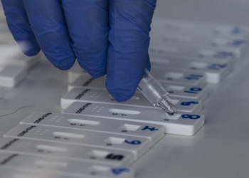 Διπλασιάστηκε η ζήτηση σε rapid και self tests στα φαρμακεία της Θεσσαλονίκης
