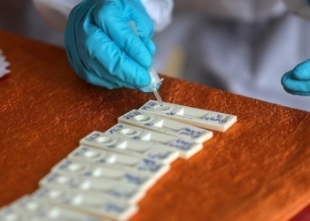 Η αύξηση των κρουσμάτων covid-19 και άλλων αναπνευστικών λοιμώξεων δοκιμάζει τις αντοχές του ΕΣΥ για 4η χρονιά